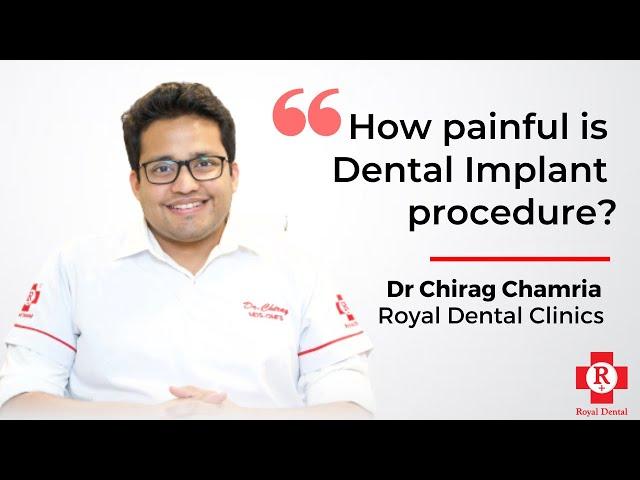 How painful is Dental Implant procedure? Dr. Chirag Chamria | Royal Dental Clinics