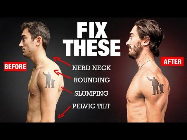 How to Fix Your Posture in 4 Moves! (PERMANENTLY)