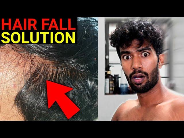 5 Steps To Stop Hairfall Instantly | Men's Lifestyle | தமிழ்