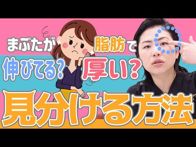 【チェック方法】まぶたが伸びているのか、脂肪で厚いのか【見分ける方法】