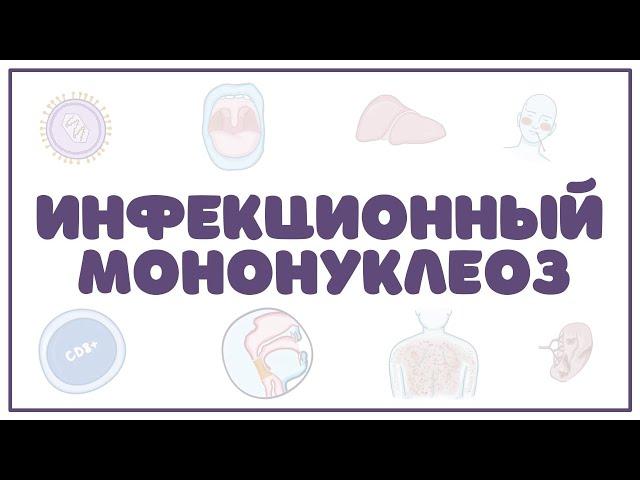 Инфекционный мононуклеоз (клиника, диагностика, лечение) лекция