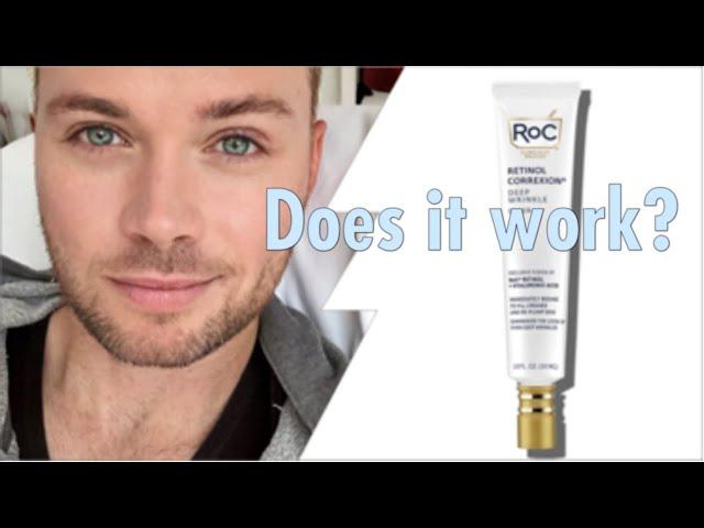 RoC Retinol Correxion Deep Wrinkle FILLER REVIEW