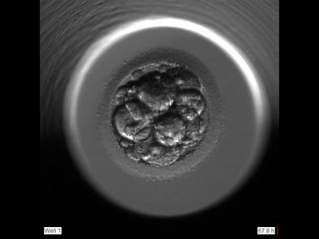 Single Embryo Transfer