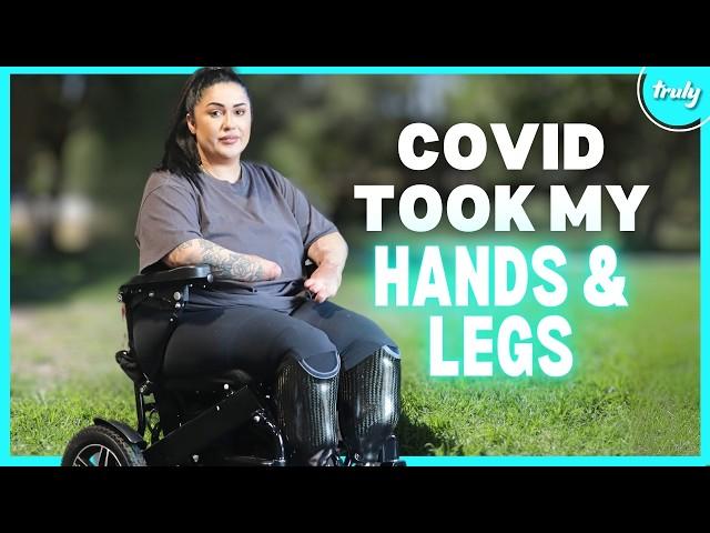 I Caught COVID-19 & Lost My Limbs | BORN DIFFERENT