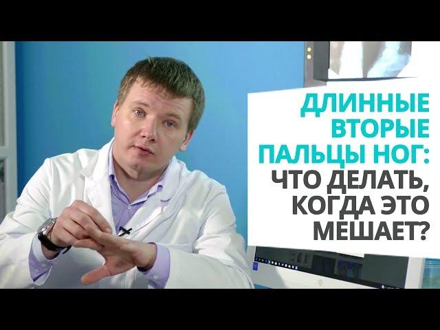 Длинные вторые пальцы ног: что делать, когда это мешает?  Доктор Алексей Олейник