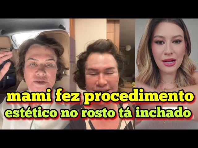 família Santina mami fez procedimento estético no rosto e tá bem inchada.