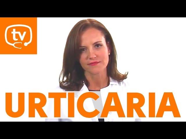 ¿Ronchas en la piel que pican? Puede ser urticaria