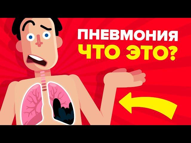 Пневмония - объяснение.