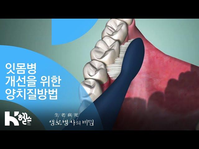 잇몸병 개선을 위한 양치질방법 - (20181114_670회 방송) 3분의 힘, 잇몸병 개선 프로젝트