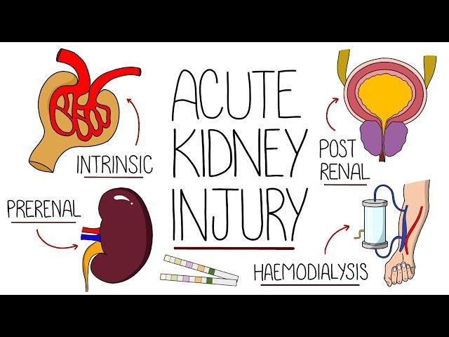 Understanding Acute Kidney Injury (AKI Made Easy)