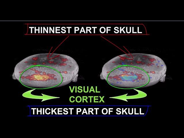 Brain Function Mapping