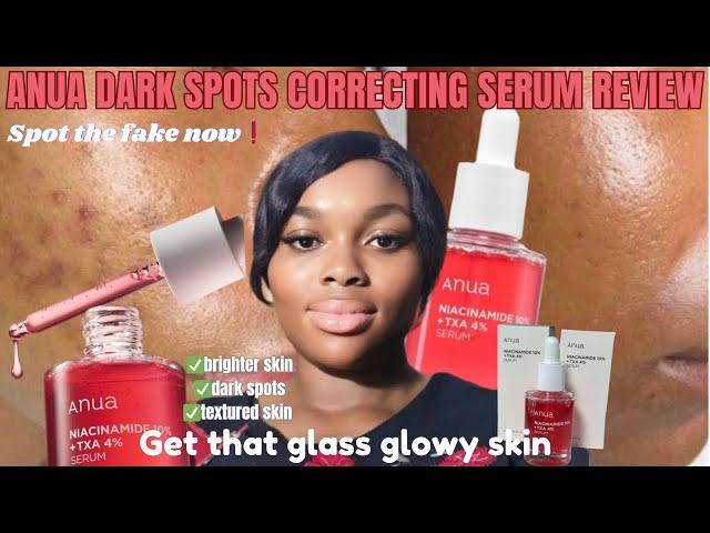 How To Get Rid Of Dark Spots Fast With Just One Productserum that works #review