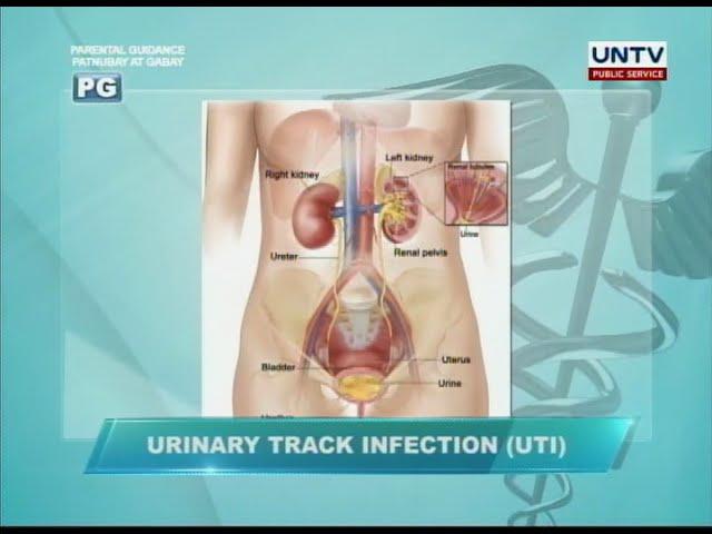 UNTV: Why women are more susceptible to urinary tract infection (UTI)