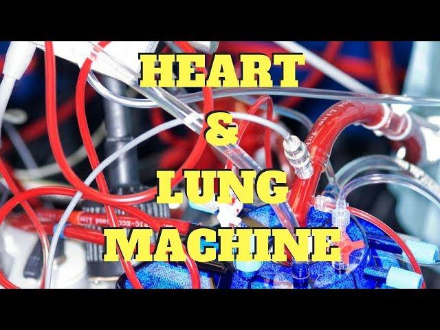 UNDERSTANDING THE HEART LUNG MACHINE