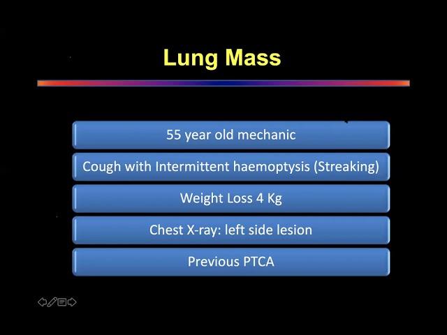 Lung Cancer case presentation