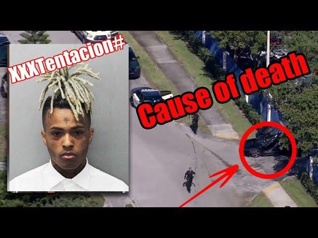 XXXTentacion Cause of Death: How Did Jahseh Dwayne Onfroy Die?