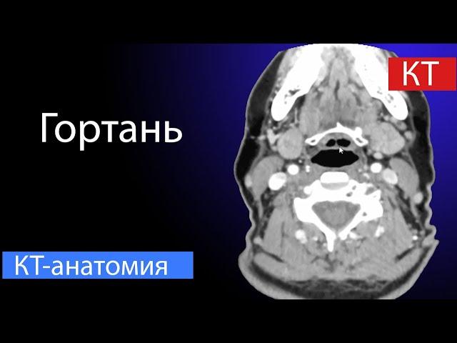 Лучевая анатомия гортани   |Лучевая диагностика|