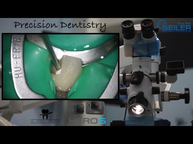 Seiler Precision Dentistry GoPro