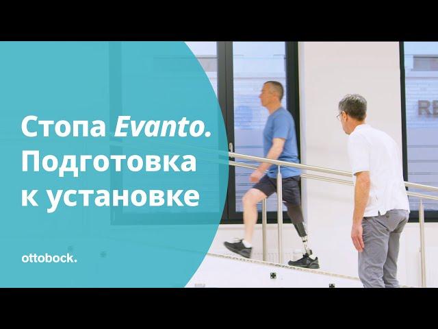 Карбоновая стопа Evanto для протезов: подготовка к установке