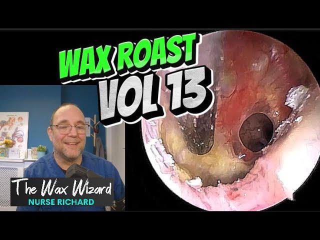 WAX ROAST VOL 13! #ear #earwax #earwaxremoval #earwaxclinic #satisfying #foryou #fyp #foryourpage