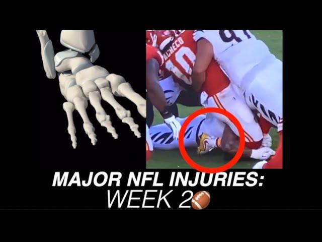 Data Analysis: NFL Week 2 Injuries | FASTEST Minute