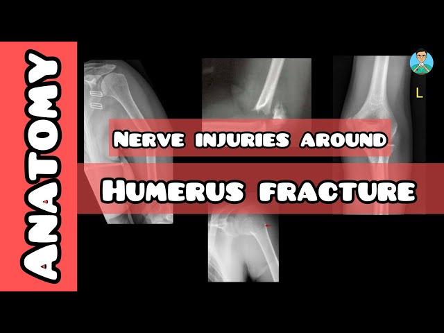 Nerve injuries related to Humerus Fracture for USMLE, NEET PG, INICET