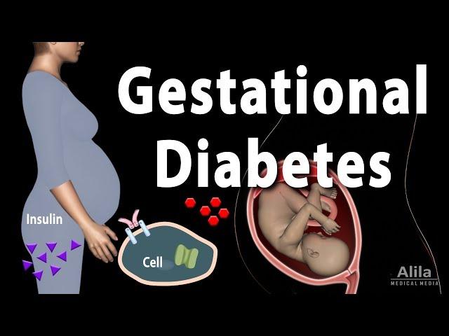 Gestational Diabetes, Animation