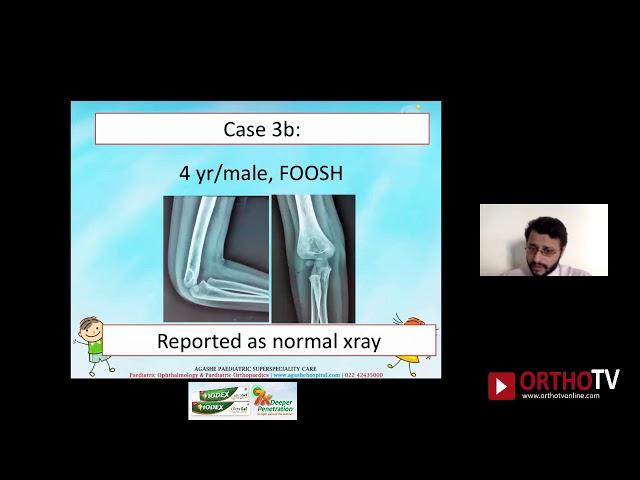 OrthoTV Original - Skeletal Xrays in Pediatric Orthopaedics - Dr Mandar Agashe