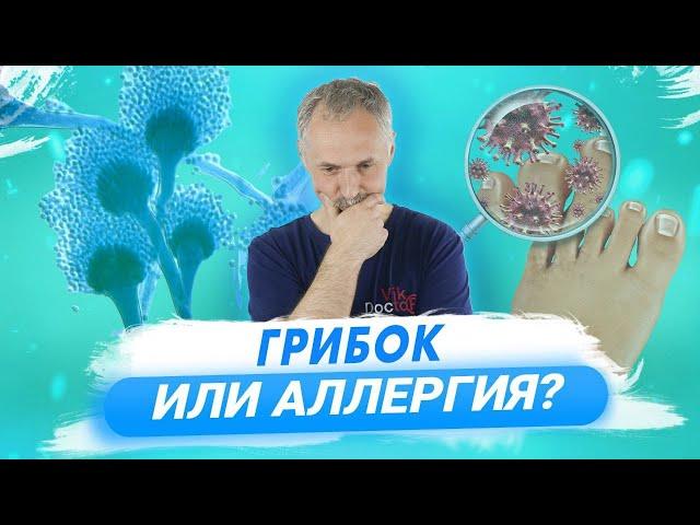 Грибок ногтей и кожи: лечение и профилактика / Доктор Виктор