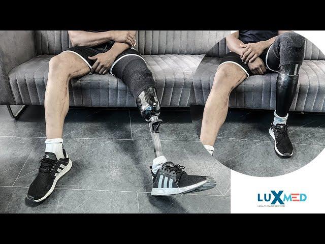 Running with a prosthetic leg below the knee | Luxmed Protez