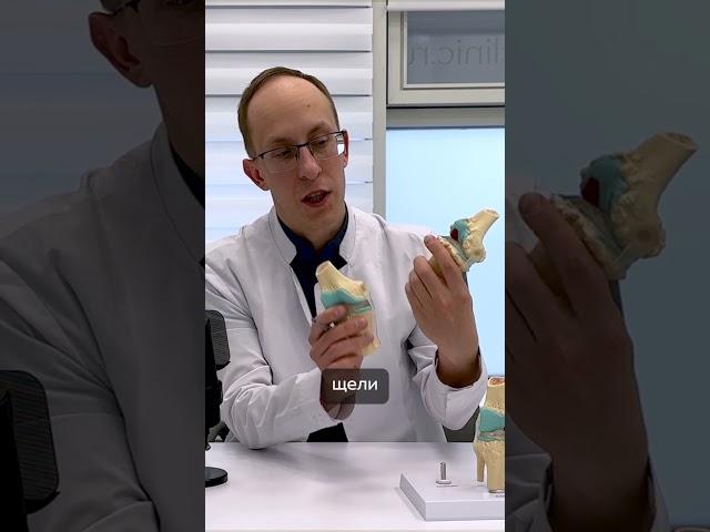 Что такое гонартроз коленного сустава?