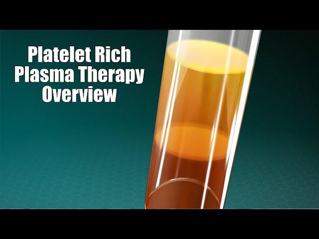 Platelet rich plasma therapy explained