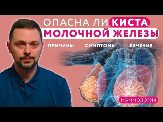  Киста молочной железы: причины, диагностика, симптомы и лечение // #клиникащербатовой #мастопатия