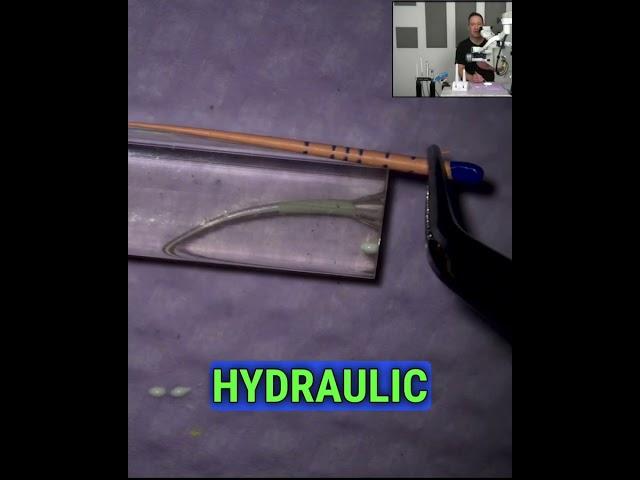 The Hydraulic Condensation Obturation Technique Demo from my Access Endo teaching studio!