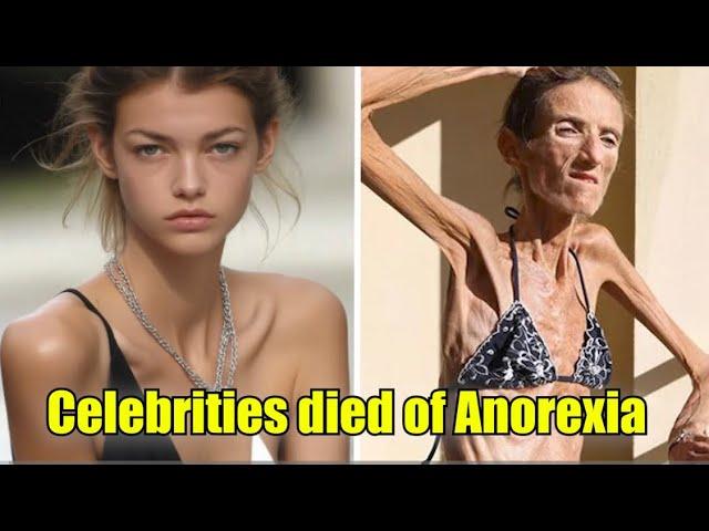 20 Celebrities  (Heartbreaking 2024 Update)