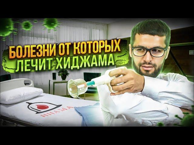 Болезни  и недуги от  которых эффективно лечить Хиджама.