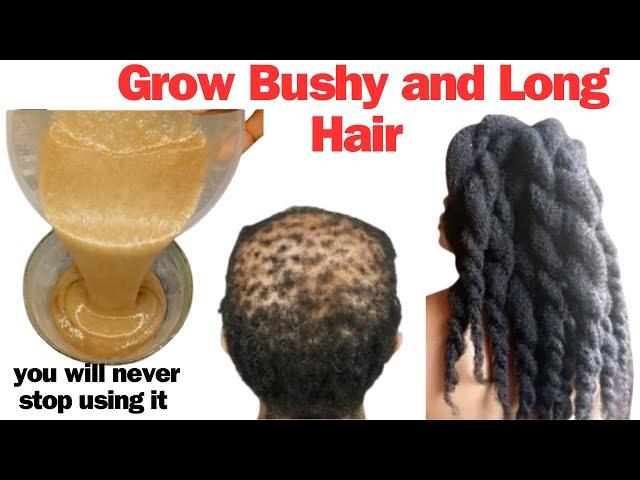 Powerful Hair Growth Mask With Only 2 Ingredients. You Will Never Stop Using It | Nells Karimi