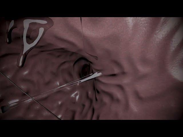 Loona Endo inspection