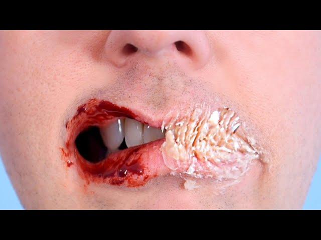 LIPS SUPER GLUED CLOSED!