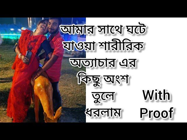 আমার সাথে ঘটে যাওয়া শারীরিক অত্যাচার এর কিছু অংশ তুলে ধরলাম with Proof