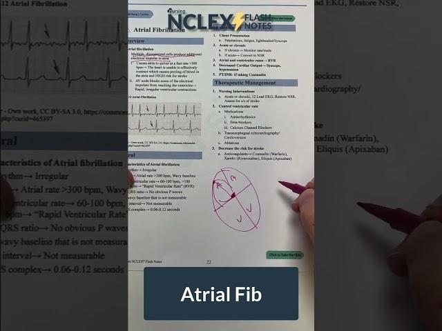 AFIB (Atrial Fibrillation) Part 1 #shorts #NCLEX #nursingschool #NCLEXprep #nursing #nursingstudent