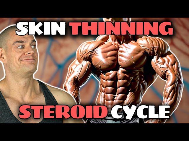 Thinning The Skin With Winstrol, Accutane, Preparation-H & White Fish (Munzer-Like Conditioning)
