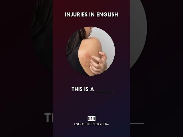 Injuries in English 