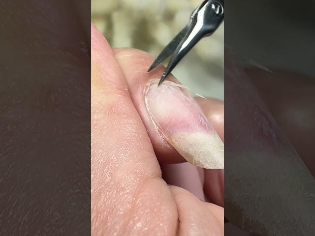 Vorsichtig bei der Nagelhautentfernung