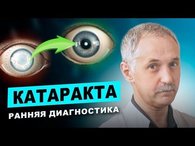 Катаракта: Симптомы, которые вы не должны игнорировать! / Доктор Виктор