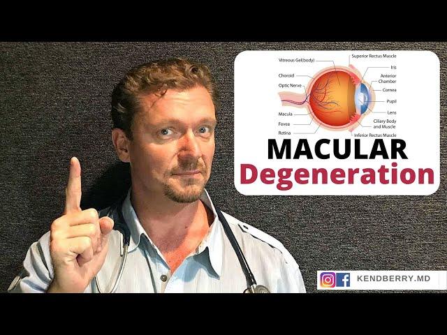 MACULAR Degeneration (Prevent It / Improve It)  2024