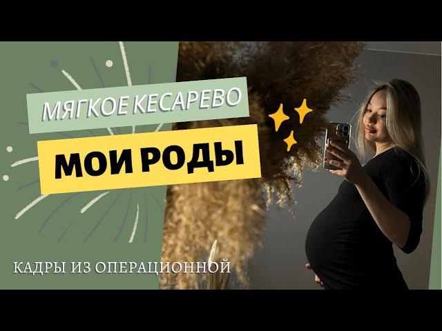 МОИ РОДЫ | МЯГКОЕ КЕСАРЕВО СЕЧЕНИЕ