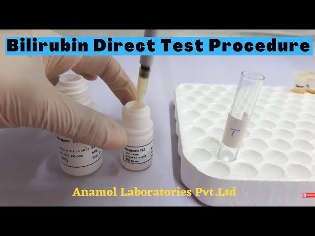 Bilirubin Test Procedure | Bilirubin Direct Test Procedure-In English