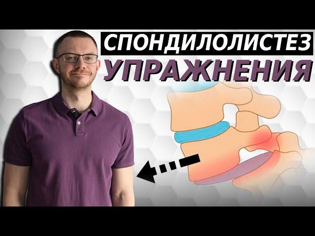 Спондилолистез поясничного и пояснично-крестцового отдела. Эффективный комплекс упражнений.