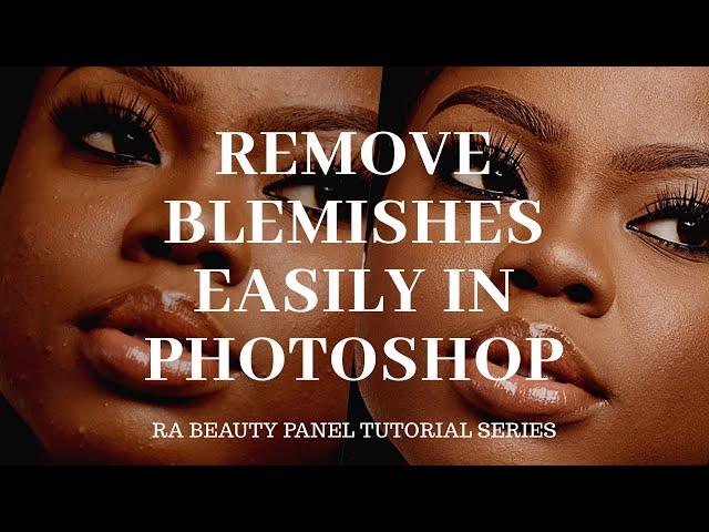 Photoshop Tutorial: Easy Blemish Removal